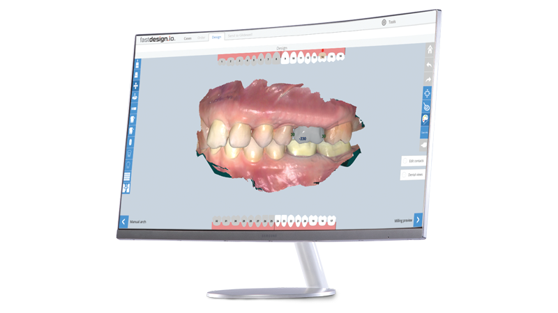 fastdesign.io in-office software and design station displaying a three-dimensional dental model